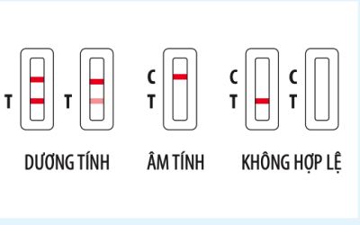 THƯ MỜI CÁC NHÀ CUNG CẤP SỐ 642 – ĐƠN VỊ CUNG CẤP KÍT TEST NHANH